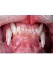 teeth